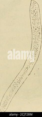 . Handbuch der specitellen Pathology und Therapie . h an denseitlichen Eändern sehen sieoftmals wie angeätzt aus, alswären sie im Zerbröckelnbegriffen. Figure 3 (S. 71) gibtAbbildungen von dunklenkörnigen Cylindern. Färbung zeigen — diewachsartig glänzendenC y 1 i n d e r. Sie sind, abge-sehen von zufälligen an-hängseln , stets homogen,unterscheiden sich aber vonder zuerst beschriebenen,gleichfals ursprünglich ganzhomogenen, aber glashellenArt durch starkes Licht-p.^ Banque D'Images