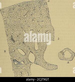 . Les éléments de l'anatomie de Quain . f substance compacte. Dans les os complexes ou mixtes, les suchas les vertébrés, les deux substances ont la même relation générale entre elles ; mais la quantité relative de chacune dans différentes parties, ainsi que leur arrangement spécial dans des cas particuliers, est très variable. Lors d'une inspection étroite, la texture de l'os est considérée comme étant parmedde barres minces ou spicula et mince lamellEe, qui se rencontrent et se rejoignent d'une manière réticulaire, produisant une structure ouverte qui a été comparée au travail de treillis (cancelU), et donc le nom habituellement MINUTE STRUCTUEE DE L'OS. Banque D'Images