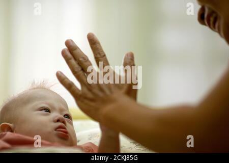 Gammy A Baby Born With Down S Syndrome Is Fed By His Surrogate Mother Pattaramon Janbua At A Hospital In Chonburi Province August 3 14 According To Pattaramon His Australian Parents Through A