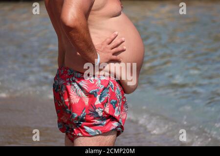 Homme avec le ventre gras debout sur une plage. Surpoids et obésité concept Banque D'Images