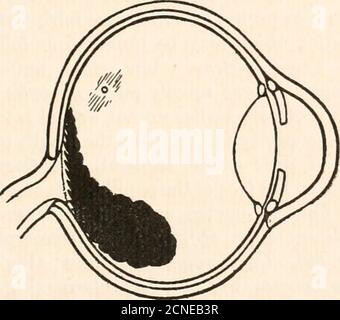 . Le fundus oculi des oiseaux, en particulier vu par l'ophtalmoscope; une étude dans l'anatomie comparative et la physiologie . Figure 24.Ostrich nubien (Struthio camelus). Figure 27.Kiwi ou Apteryx (Apteryx mantelli). Banque D'Images