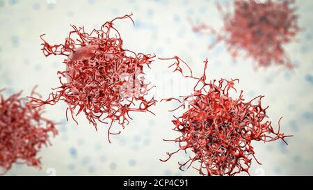 Cellules du cancer du col de l'utérus, illustration informatique. Banque D'Images
