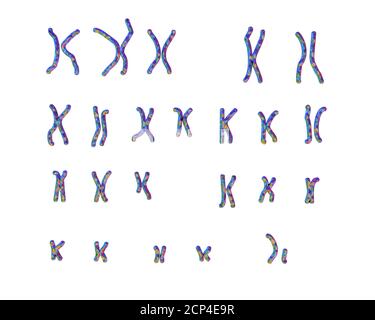 Caryotype du syndrome d'Angelman (AS), illustration informatique. TOUT COMME un trouble génétique caractérisé par des mouvements de bras, des rires excessives (même en cas de blessure Banque D'Images