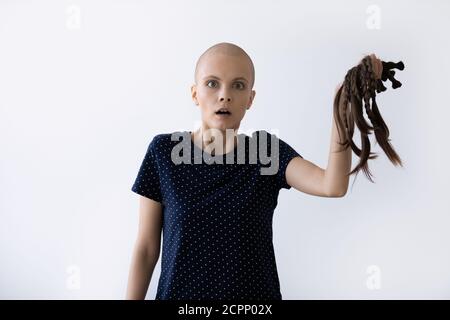 Femme bald malade effrayée aux prises avec le cancer, se délasse des cheveux Banque D'Images