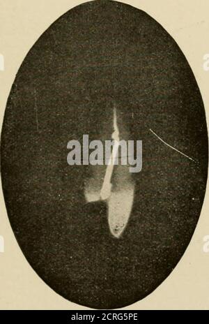 . Radiographie élémentaire et dentaire / par Howard Riley Raper . Fig. r&gt;07. L'eau tombée dans un tube en verre sec ne va pas à l'extrémité du tube en raison de l'air piégé. La solution de colophane devrait être travaillée aux extrémités des canaux racinaires avec du broch fin. Banque D'Images