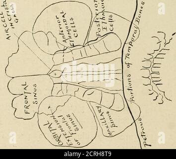 . Radiographie élémentaire et dentaire / par Howard Riley Raper . Figure 374. Radiographie faite à partir de la pose, Fig. 372. {Journal médical Interstate.) U*. Figure 375. Dessin schématique explicatif de la radiographie, Fig. 374. (Interstate Medical Journal.) RÉALISATION DE RADIOGRAPHIES DENTAIRES 343 Banque D'Images