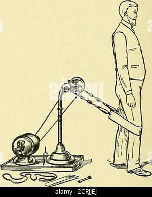 . Les utilisations médicales et chirurgicales de l'électricité : y compris les rayons X, la lumière de Finsen, les traitements vibratoires, et les courants à haute fréquence . Cochon. 232.—application vers l'arrière. Figure 233.—application au genou. Banque D'Images