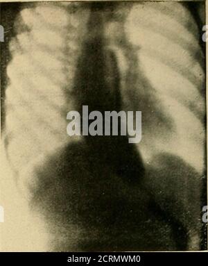 . Le tube digestif : une étude radiographique . Fig., ii. Fig. :. 12. Banque D'Images
