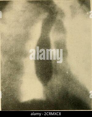 . Le tube digestif : une étude radiographique . Figure 7. Fig. 8. Banque D'Images