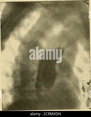 . Le tube digestif : une étude radiographique . Figure 7. Fig. 8.. Banque D'Images