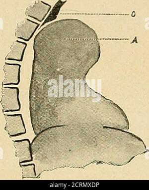 . Le tube digestif : une étude radiographique . Fig. 3 Banque D'Images