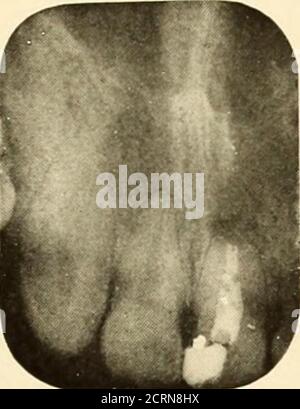 . Roentgoenologie orale : étude de Roentgen sur l'anatomie et la pathologie de la cavité buccale . Banque D'Images