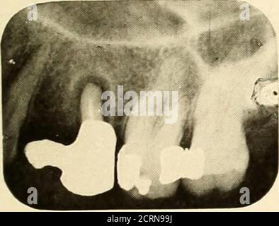 . Roentgoenologie orale : étude de Roentgen sur l'anatomie et la pathologie de la cavité buccale . Banque D'Images