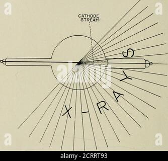 . Radiographie élémentaire et dentaire . F!g. 4-). Montrant la manière de connecter la troisième borne de la bobine à la chambre de régulation. La chambre de régulation contient de l'amiante imprégné d'hydrate de sodium ou de potassium, par exemple. Lorsque le currentpasse dans la chambre de régulation, la chaleur est créée . ce qui provoque la sortie de gaz par le mécémique. Ces gaz réduisent le vide du tubeso que le courant peut passer directement de l'anode à la cathode. Lorsque le tube de RADIOGRAPHIE élémentaire 4* refroidit complètement, en quinze à trente minutes, les bases sont prises ag Banque D'Images