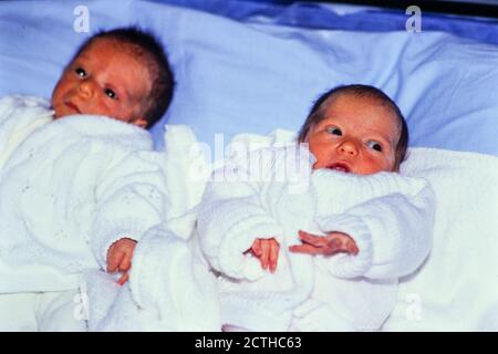 Naissance de jumeaux après fécondation in vitro, Lyon, France, .Archives 90ies VOIR RESTRICTION Banque D'Images