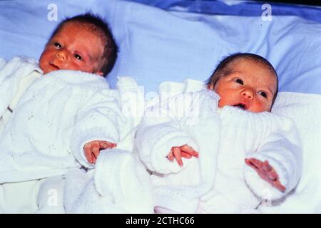 Naissance de jumeaux après fécondation in vitro, Lyon, France, .Archives 90ies VOIR RESTRICTION Banque D'Images