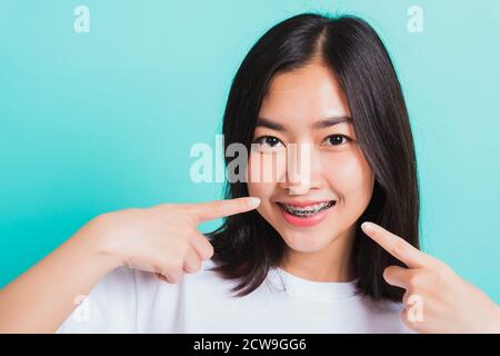 Portrait de l'asiatique de l'adolescence belle jeune femme sourire ont des bretelles dentaires sur les dents riant point doigt sa bouche, studio tourné isolé sur un backgro bleu Banque D'Images