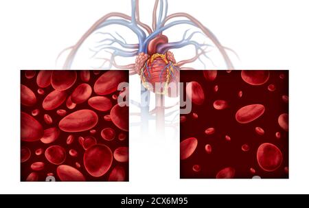 Schéma médical de l'anémie et de l'anémie concept comme nombre normal et anormal de cellules sanguines et circulation humaine dans une artère ou une veine comme une illustration 3D. Banque D'Images