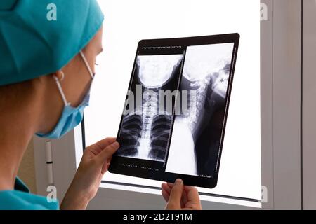 Vue latérale d'une jeune femme médecin spécialiste en blouse chirurgicale Et masque de protection examinant l'image radiographique du cou cervical colonne vertébrale du patient à l'hôpital Banque D'Images