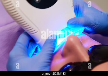 Portrait en gros plan d'une patiente chez le dentiste de la clinique. Procédure de blanchiment des dents avec une lampe UV à rayons ultraviolets. dof peu profond Banque D'Images