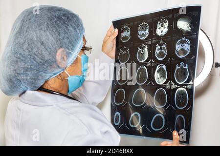 Une neurologue femelle indienne examine une plaque d'acquisition CT du cerveau à une clinique de santé Banque D'Images