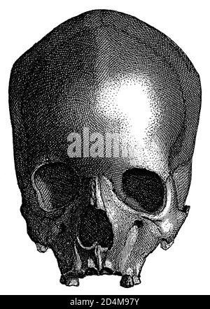 Gravure d'un crâne humain préhistorique. Publié dans Systematischer Bilder-Atlas zum conversations-Lexikon, Ikonographische Encyklopedie der Wissensc Banque D'Images