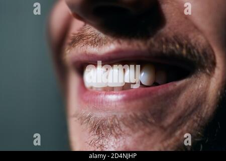 Sourire crasseux du jeune homme. Vue rapprochée des dents blanches. Banque D'Images