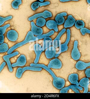 Particules du virus de Marburg Micrographe électronique de transmission colorisée des particules du virus de Marburg (bleu) récoltées à partir du surnageant de cellules infectées VERO E6. Banque D'Images