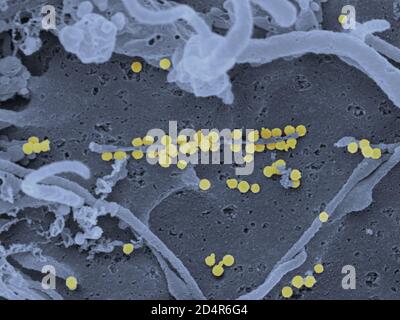 Micrographe électronique à transmission colorée (TEM) des virus de la fièvre hémorragique de Crimée-Congo (CCHF) (marron). Le CCHF est transmis aux humains lorsqu'ils ont un Banque D'Images