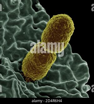 Klebsiella pneumoniae bactérie Micrographe électronique à balayage colorisé montrant Klebsiella résistante au carbapénème pneumoniae en interaction avec un neu humain Banque D'Images