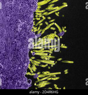 Particules du virus de la grippe porcine Micrographe électronique à transmission colorisée de SW31 (souche porcine) particules du virus de la grippe (vertes) attachées à et en bourgeonnement Banque D'Images