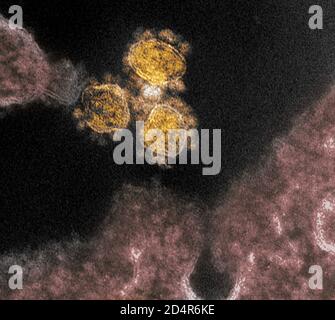 Cette image du microscope électronique à transmission montre le SRAS-CoV-2, le virus qui cause le COVID-19, isolé d'un patient dans les particules virales américaines (rou Banque D'Images