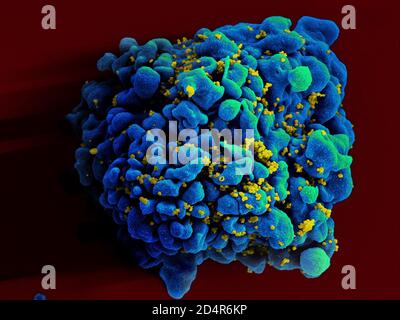 Cellule T H9 infectée par le VIH électromicrographe d'une cellule T H9 infectée par le VIH. Crédit: NIAID ; créations: NIAID Banque D'Images