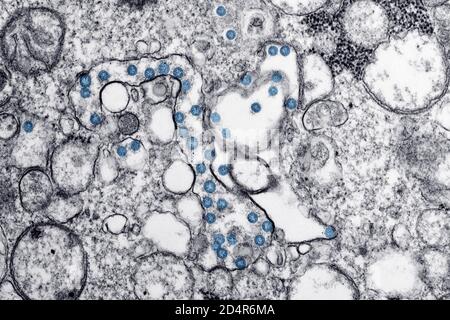 Transmission image microscopique d'un isolat du premier cas américain de COVID-19, anciennement connu sous le nom de 2019-nCoV. Les particules virales sphériques Banque D'Images