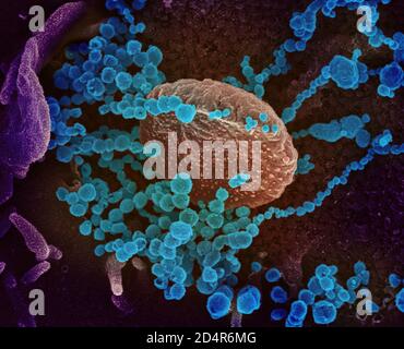 Cette image au microscope électronique à balayage montre le SRAS-COV-2 (objets ronds bleus) émergeant de la surface des cellules cultivées en laboratoire. SRAS-COV-2, également Banque D'Images