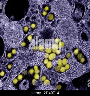 Cette image au microscope électronique à transmission montre le SRAS-COV-2, également connu sous le nom de 2019-nCoV, le virus qui cause le COVID-1, isolé d'un patient aux États-Unis Banque D'Images