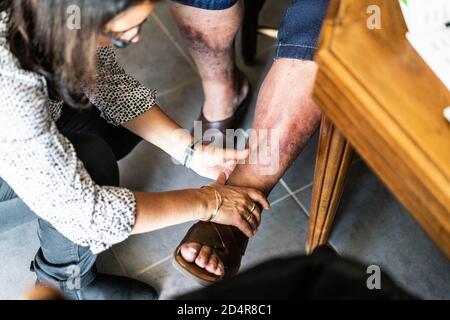 Généraliste examinant un ulcère de jambe d'une personne âgée lors d'une visite à domicile, France. Banque D'Images