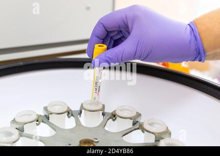 Covid-19. Un travailleur en gants médicaux dépose un échantillon dans une centrifugeuse de laboratoire, en gros plan. Concept de recherche scientifique et médicale du coronavirus Banque D'Images