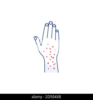 Icône de la ligne d'éruption cutanée isolée sur la main Contour blanche Illustration de Vecteur