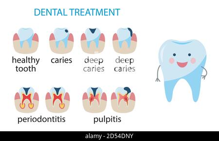 Affiche de traitement dentaire. Icône maladies des dents. Caries, pulpite, parodontite. Dent humaine de style plat. Illustration vectorielle isolée sur blanc, Illustration de Vecteur