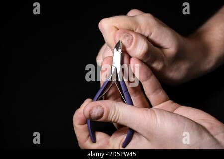 Homme main ongles endommagés. Ongles mordus. Soins des ongles. Manucure hommes. Problèmes de plaque à clous. Mains . Isolé sur un fond noir. Banque D'Images