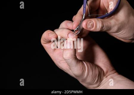 Homme main ongles endommagés. Ongles mordus. Soins des ongles. Manucure hommes. Problèmes de plaque à clous. Mains . Isolé sur un fond noir. Banque D'Images