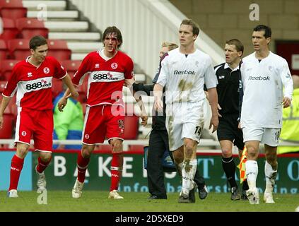 Emanuel Pogatetz de Middlesbrough (deuxième à gauche) est laissé avec un visage sanglant après un conflit avec Kevin Davies de Bolton Wanderers (deuxième à droite) Banque D'Images