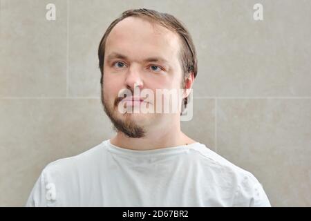 Avant et après le rasage. Portrait de collage homme avec une demi-barbe. Visage homme 35-40 ans. Concept de l'aspect inconnu et des problèmes isolés de t Banque D'Images