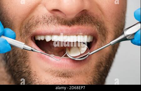 Sourire blanc et sain avec sonde parodontale et miroir buccal, gros plan. Traitement des dents. Tirer une partie de la tête Banque D'Images