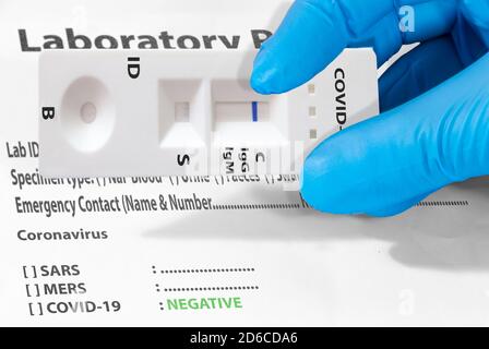 La main d'un médecin ou d'un technicien de laboratoire montre un test de laboratoire rapide COVID-19 pour détecter les anticorps IgM et IgG contre le nouveau coronavirus, le COV-SRAS-2 WIT Banque D'Images