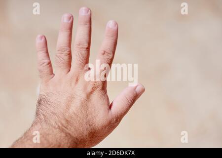 Un homme choqué de la peau ridée et pruneuse de ses mains après le bain, ou d'être dans l'eau Banque D'Images