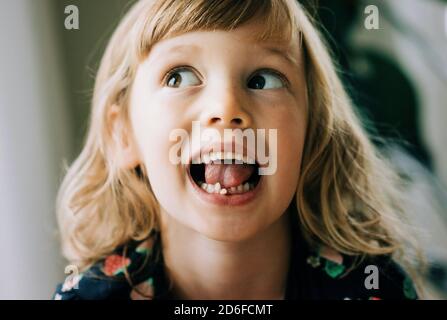 jeune fille avec une dent bancale tirant des visages montrant sa dent Banque D'Images