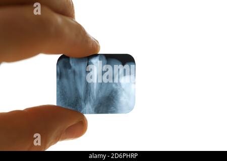 Dent x-ray dans la main de l'homme de près Banque D'Images