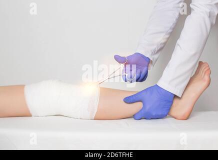 Le médecin chirurgien enlève le plâtre moulé sur le genou du patient à l'aide de ciseaux médicaux. Concept rupture de la patella et rupture du quad Banque D'Images